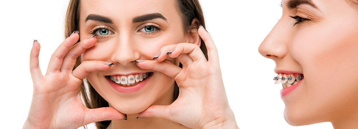 ارتودنسی و جراحی فک چه رابطه ای با هم دارند؟